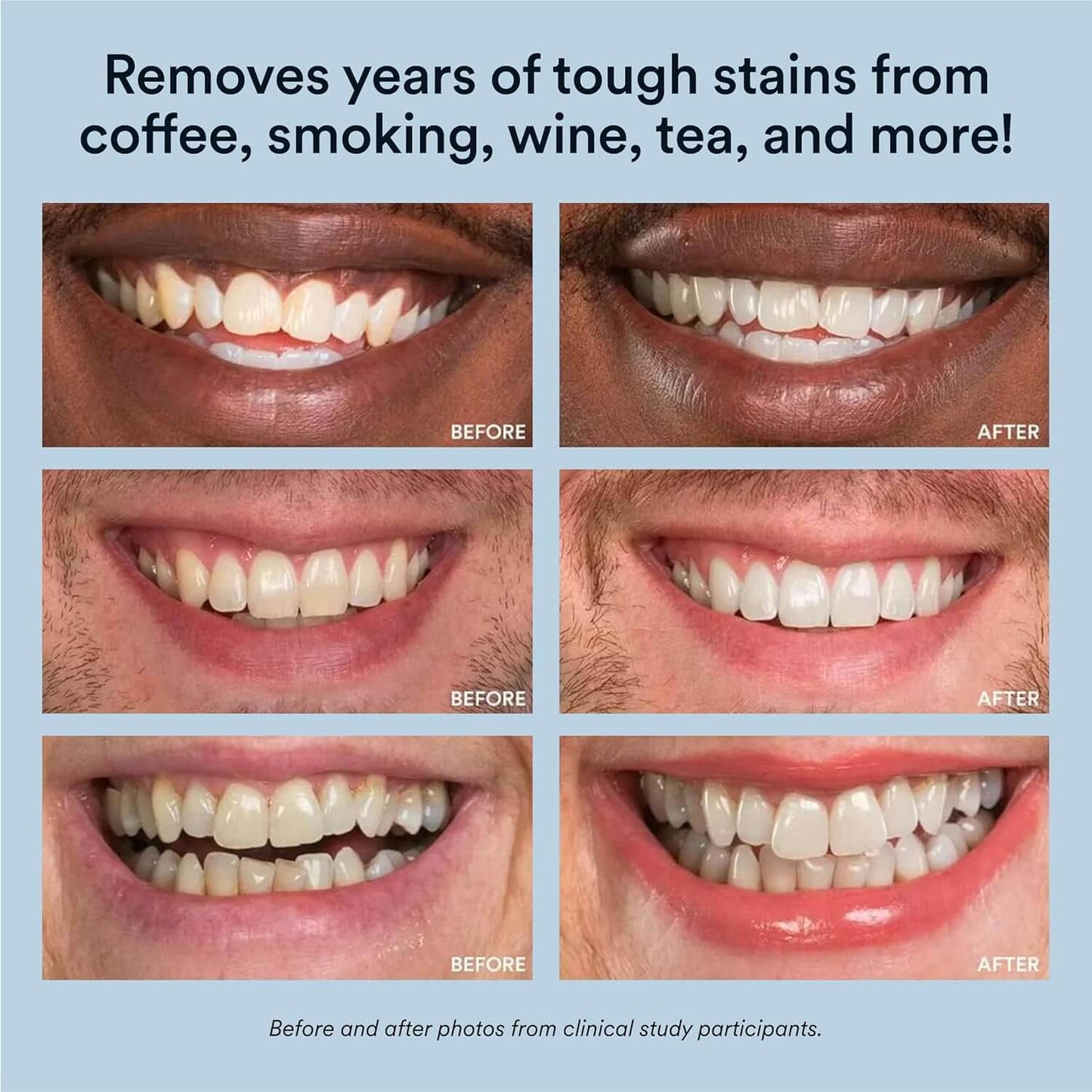 Auraglow Whitening Booster