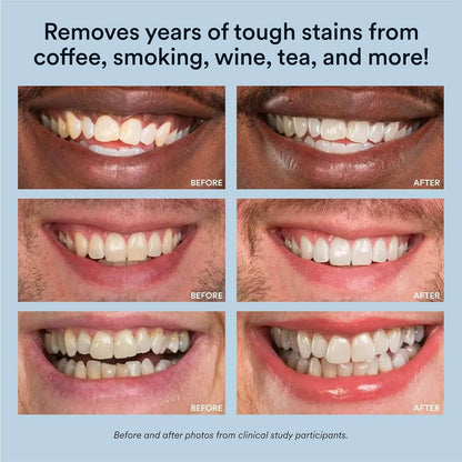 Auraglow Whitening Booster